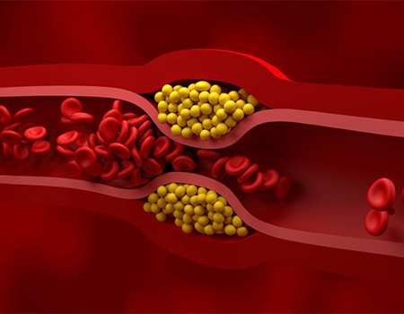 Blood vessel containing red and yellow blood cells.
